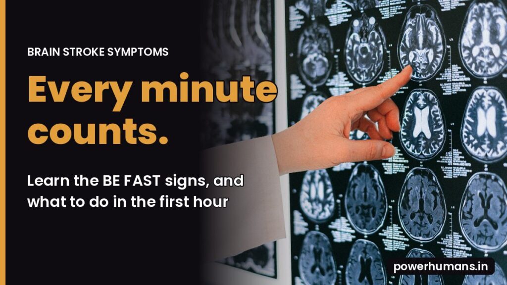 Brain stroke symptoms featured image: a doctor points at brain MRI scans with the text Every minute counts, learn the BE FAST signs